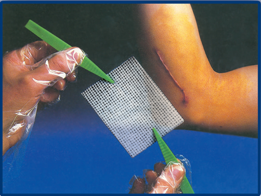 Pharmatull, pansament tip plasa cu parafina