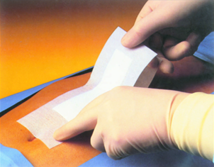 Pansament steril postoperator Pharmapore